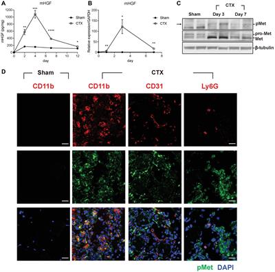 Hepatocyte Growth Factor Regulates Macrophage Transition to the M2 Phenotype and Promotes Murine Skeletal Muscle Regeneration